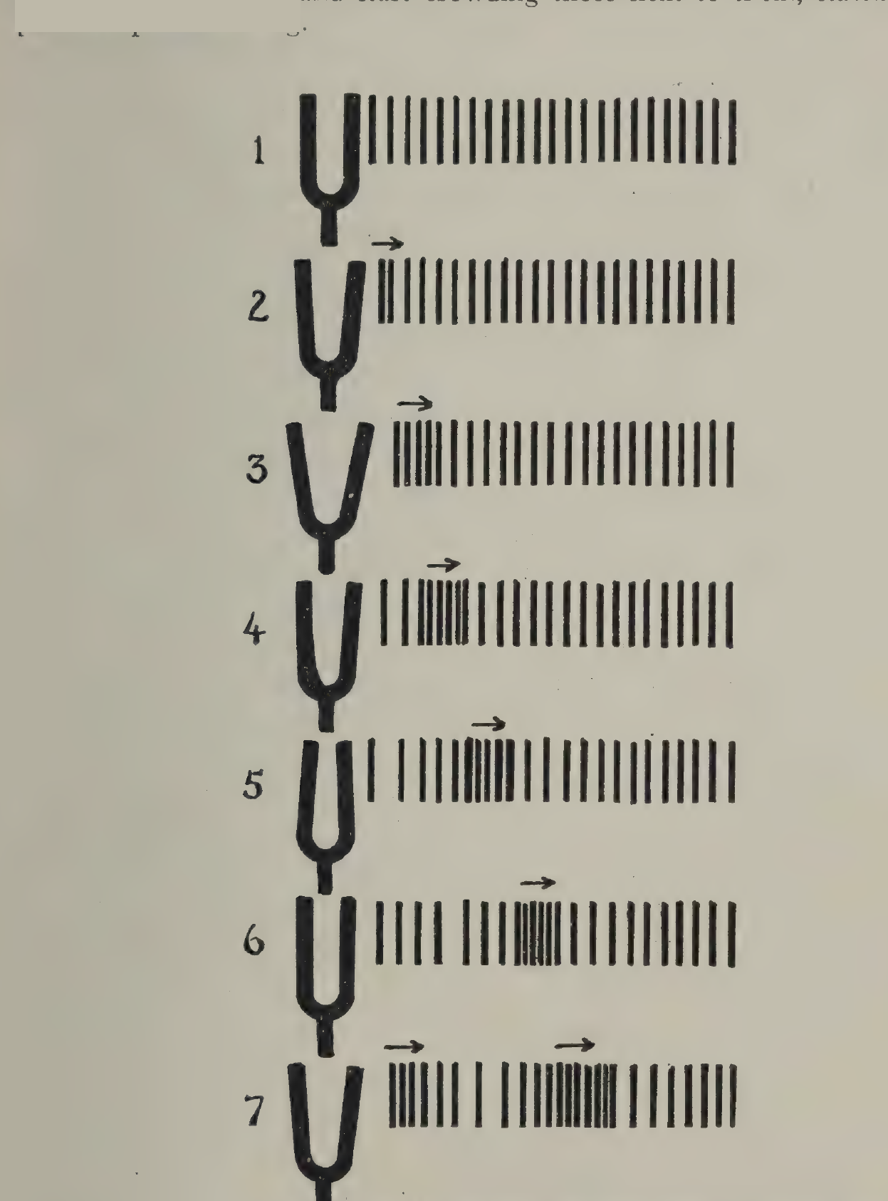 FIG:18